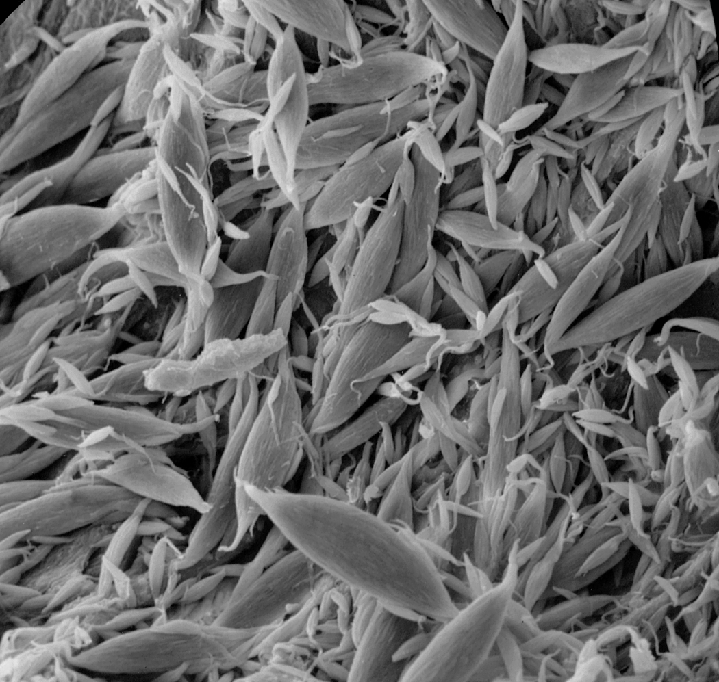 Spermatozeugmy w aspermatogenicznej czesci jądra Mimagoniates barberi. Mikroskop elektronowy skaningowy