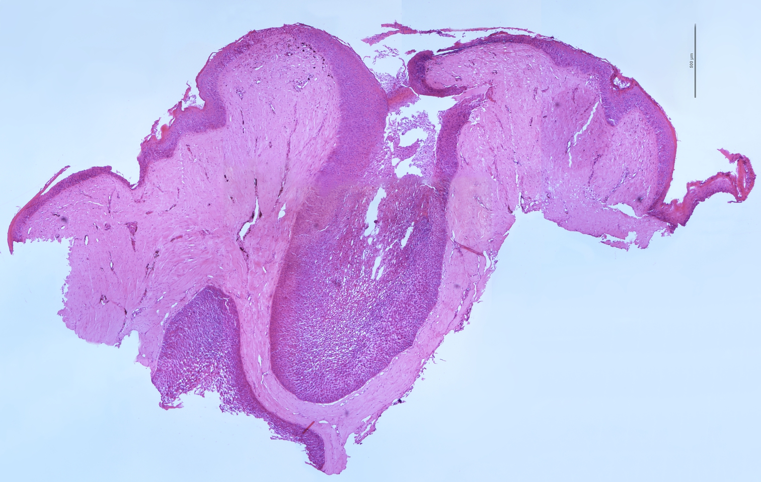 Histology of the gland of M. leprosa 